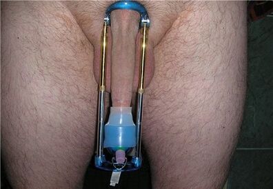 extensor para aumentar un membro